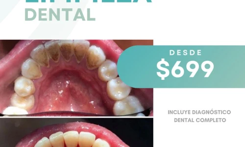 dentista en guadalajara